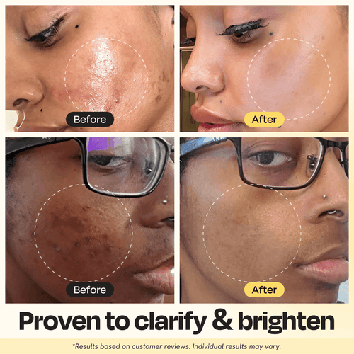 10-Minute Natural Vitamin C Clay Mask