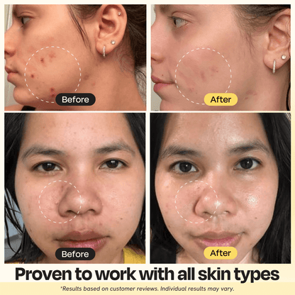 10-Minute Natural Vitamin C Clay Mask
